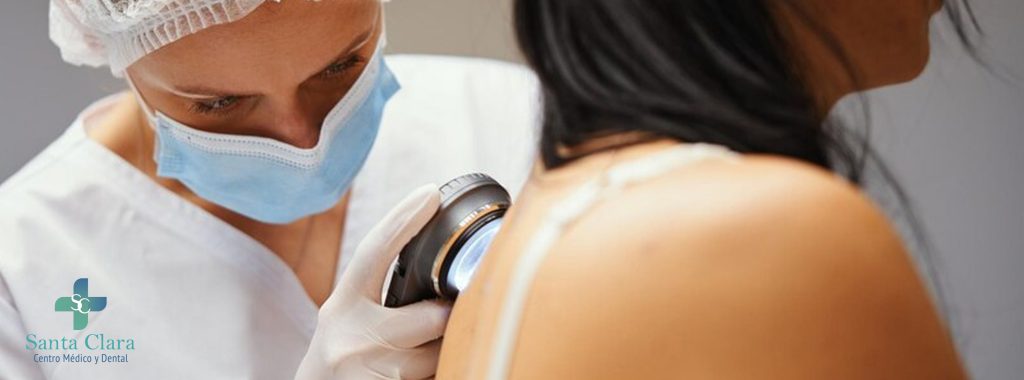 5 razones para consultar a un dermatologo 2