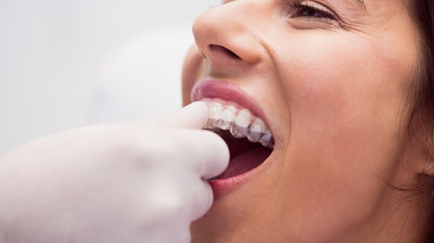 REHABILITACIÓN ORAL